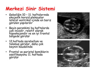 Merkezi Sinir Sistemi
• Gebeliğin 10 – 11. haftalarında
ekojenik koroid pleksuslar
lateral ventrikül içinde en bariz
görülen yapılardır
• Beyin parankimi bu haftalarda
çok incedir, relatif olarak
hipoekojendir ve en iyi frontal
bölgede görülür
• 12.haftada serebellum ve
talamus görülür, daha çok
beynin kaudalinde
• Frontal ve parietal kemiklerin
ossifikasyonu 11. haftada
görülür
 
