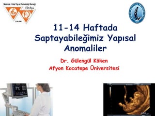 11-14 Haftada
Saptayabileğimiz Yapısal
Anomaliler
Dr. Gülengül Köken
Afyon Kocatepe Üniversitesi
 