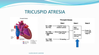 TRICUSPID ATRESIA 
GLENN SHUNT-A REVIEW 
 