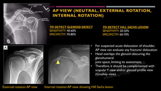 Acute Full Rotation Glenohumeral instability Radiological evaluation - Dr Srivatsa Gumma | PDF