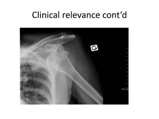 Clinical relevance cont’d
 