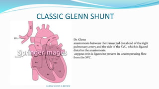 CLASSIC GLENN SHUNT
Dr. Glenn
anastomosis between the transected distal end of the right
pulmonary artery and the side of the SVC, which is ligated
distal to the anastomosis.
azygous vein is ligated to prevent its decompressing flow
from the SVC.
GLENN SHUNT-A REVIEW
 