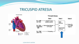 TRICUSPID ATRESIA
GLENN SHUNT-A REVIEW
 