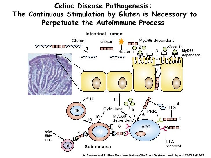 Gliadin, Intestinal Permeability, and Celiac Disease From Innate Imm…