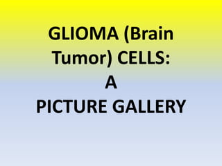 GLIOMA (Brain
  Tumor) CELLS:
       A
PICTURE GALLERY
 