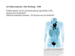 2) Células tumorais: Otto Warburg – 1920
Células tumores Ascites convertem glicose equivalente a 30%
do peso seco em lactato/h.
(Músculo esquelético humano = 6% do peso seco em lactato/h)
 
