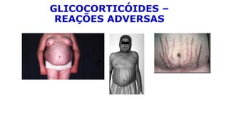 GLICOCORTICÓIDES –
REAÇÕES ADVERSAS
 