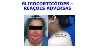 GLICOCORTICÓIDES –
REAÇÕES ADVERSAS
 
