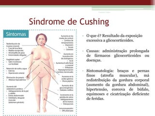 Vanessa Cunha

Síndrome de Cushing
• O que é? Resultado da exposição
excessiva a glicocorticoides.
• Causas: administração prolongada
de fármacos glicocorticoides ou
doenças.

• Sintomatologia: braços e pernas
finos
(atrofia
muscular),
má
redistribuição da gordura corporal
(aumento da gordura abdominal),
hipertensão, corcova de búfalo,
equimoses e cicatrização deficiente
de feridas.

 