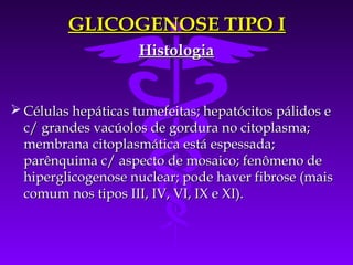 GLICOGENOSE TIPO I
                     Histologia


 Células hepáticas tumefeitas; hepatócitos pálidos e
  c/ grandes vacúolos de gordura no citoplasma;
  membrana citoplasmática está espessada;
  parênquima c/ aspecto de mosaico; fenômeno de
  hiperglicogenose nuclear; pode haver fibrose (mais
  comum nos tipos III, IV, VI, IX e XI).
 