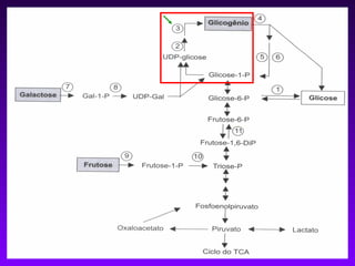 GLICOGENOSE TIPO IV

 Autossômica recessiva.

 Forma menos comum.

 Deficiência da enzima ramificadora (acúmulo
  de amilopectina).

 Estrutura do glicogênio está alterada.
 