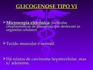 GLICOGENOSE TIPO VI

 Microscopia eletrônica: partículas
 citoplasmáticas de glicogênio que deslocam as
 organelas celulares.


 Tecido muscular é normal.


 Há relatos de carcinoma hepatocelular, mas
  s/ adenoma.
 