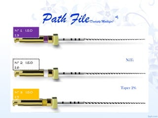 Path File   (Dentsply Maillefer)
                                              


N° 1 ISO
13




                       ...