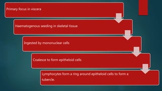 Primary focus in viscera
Haematogenous seeding in skeletal tissue
Ingested by mononuclear cells
Coalesce to form epitheloid cells
Lymphocytes form a ring around epitheloid cells to form a
tubercle.
 