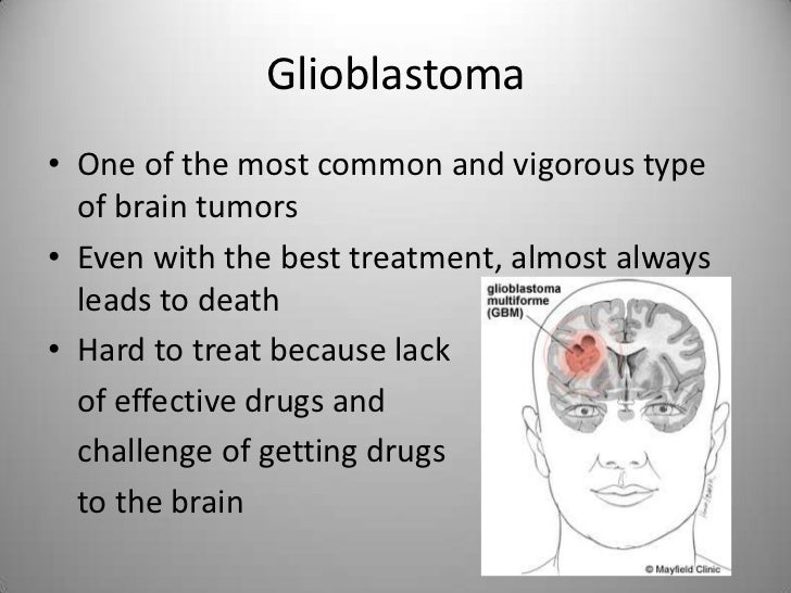 Glioblastoma Presentation