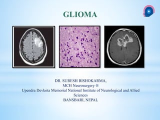 cka
GLIOMA
DR. SURESH BISHOKARMA,
MCH Neurosurgery ®
Upendra Devkota Memorial National Institute of Neurological and Allied
Sciences
BANSBARI, NEPAL
 