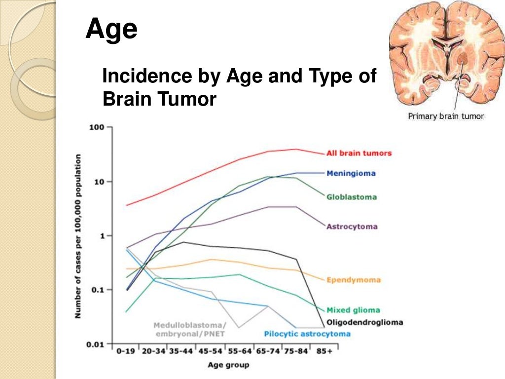 Radiation for Glioblastoma