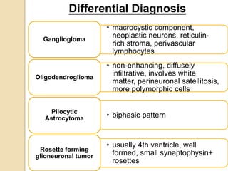 • macrocystic component,
neoplastic neurons, reticulin-
rich stroma, perivascular
lymphocytes
Gangliogloma
• non-enhancing, diffusely
infiltrative, involves white
matter, perineuronal satellitosis,
more polymorphic cells
Oligodendroglioma
• biphasic patternPilocytic
Astrocytoma
• usually 4th ventricle, well
formed, small synaptophysin+
rosettes
Rosette forming
glioneuronal tumor
Differential Diagnosis
 
