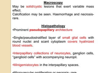 Macroscopy
May be solid/cystic lesions that exert variable mass
effect.
Calcification may be seen. Haemorrhage and necrosis-
rare.
Histopathology
•Prominent pseudopapillary architecture
•Single/pseudostratified layer of small glial cells with
round nuclei and scant cytoplasm covers hyalinized
blood vessels.
•Interpapillary collections of neurocytes, ganglion cells,
“ganglioid cells” with accompanying neuropil.
•Minigemistocytes in the interpapillary spaces.
 