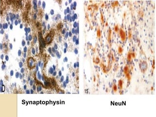 Synaptophysin NeuN
 