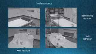 Instruments
Boomerang
retractor
Side
retractor
Kent retractor
 