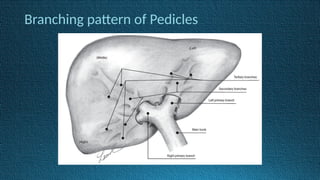 Branching pattern of Pedicles
 