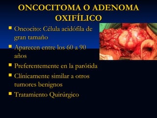 ONCOCITOMA O ADENOMA
OXIFÍLICO









Oncocito: Célula acidófila de
gran tamaño
Aparecen entre los 60 a 90
años
Preferentemente en la parótida
Clínicamente similar a otros
tumores benignos
Tratamiento Quirúrgico

 