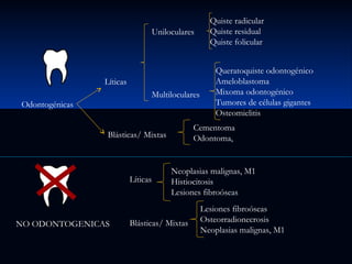 Uniloculares

Líticas
Multiloculares

Odontogénicas

NO ODONTOGENICAS

Queratoquiste odontogénico
Ameloblastoma
Mixoma odontogénico
Tumores de células gigantes
Osteomielitis

Cementoma
Odontoma,

Blásticas/ Mixtas

Líticas

Quiste radicular
Quiste residual
Quiste folicular

Neoplasias malignas, M1
Histiocitosis
Lesiones fibroóseas

Blásticas/ Mixtas

Lesiones fibroóseas
Osteorradionecrosis
Neoplasias malignas, M1

 