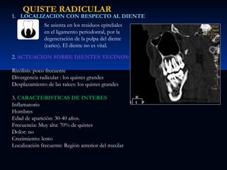 QUISTE RADICULAR

1. LOCALIZACION CON RESPECTO AL DIENTE
Se asienta en los residuos epiteliales
en el ligamento periodontal, por la
degeneración de la pulpa del diente
(caries). El diente no es vital.
2. ACTUACION SOBRE DIENTES VECINOS:
Rizólisis: poco frecuente
Divergencia radicular : los quistes grandes
Desplazamiento de las raíces: los quistes grandes
3. CARACTERISTICAS DE INTERES
Inflamatorio
Hombres
Edad de aparición: 30-40 años.
Frecuencia: Muy alta: 70% de quistes
Dolor: no
Crecimiento: lento
Localización frecuente: Región anterior del maxilar

 
