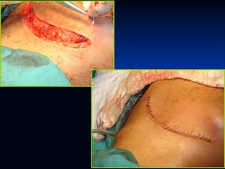 Glándulas salivales