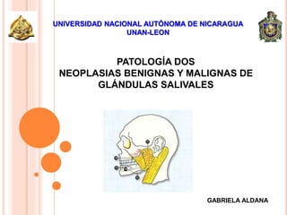 UNIVERSIDAD NACIONAL AUTÓNOMA DE NICARAGUA
UNAN-LEON
PATOLOGÍA DOS
NEOPLASIAS BENIGNAS Y MALIGNAS DE
GLÁNDULAS SALIVALES
GABRIELA ALDANA
 