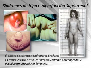 Síndromes de Hipo e Hiperfunción Suprarrenal




 El exceso de secreción andrógenos produce:
 La masculinización esto es llamado Síndrome Adrenogenital y
 Pseudohermafroditismo femenino.
 