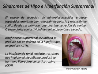 Síndromes de Hipo e Hiperfunción Suprarrenal

 El exceso de secreción de mineralocorticoides produce
 Hiperaldosteronismo, por reducción de potasio y retención de
 sodio. Puede ser primario, que deprime secreción de renina.
 O secundario, con actividad de renina plasmática elevada.

 Insuficiencia suprarrenal secundaria se
 produce por un defecto en la hipófisis que
 no produce ACTH.

 La insuficiencia renal terciaria trastornos
 que impiden al hipotálamo producir la
 hormona liberadora de corticotropina
 (CRH).
                                               INSUFICIENCIA RENAL
 