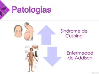 Sindrome de
Cushing
Enfermedad
de Addison
 