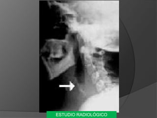 ESTUDIO RADIOLÓGICO
 