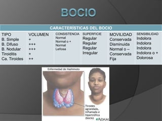 CARACTERÍSTICAS DEL BOCIO
TIPO
B. Simple
B. Difuso
B. Nodular
Tiroiditis
Ca. Tiroides
VOLUMEN
+
+++
+++
+
++
CONSISTENCIA
Normal
Normal o +
Normal
Leñosa
SUPERFICIE
Regular
Regular
Regular
Irregular
MOVILIDAD
Conservada
Disminuida
Normal o –
Conservada
Fija
SENSIBILIDAD
Indolora
Indolora
Indolora
Indolora o +
Dolorosa
 