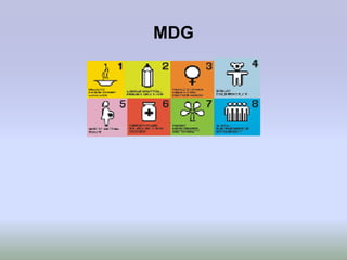 MDG
 