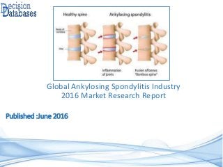Published :June 2016
Global Ankylosing Spondylitis Industry
2016 Market Research Report
 