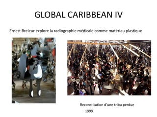 GLOBAL CARIBBEAN IV
Ernest Breleur explore la radiographie médicale comme matériau plastique
Reconstitution d’une tribu perdue
1999
 