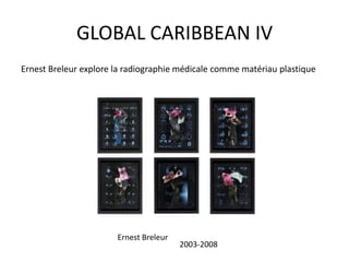 GLOBAL CARIBBEAN IV
Ernest Breleur explore la radiographie médicale comme matériau plastique
Ernest Breleur
2003-2008
 