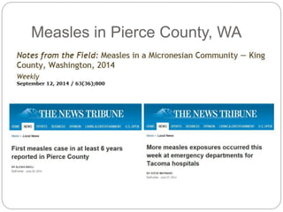 Measles in Pierce County, WA
 