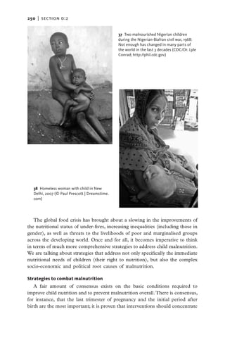 250   |  section d:2


                                                37 Two malnourished Nigerian children
                                                during the Nigerian-Biafran civil war, 1968:
                                                Not enough has changed in many parts of
                                                the world in the last 3 decades (CDC/Dr. Lyle
                                                Conrad; http://phil.cdc.gov)




   38  Homeless woman with child in New
   Delhi, 2007 (© Paul Prescott | Dreamstime.
   com)




   The global food crisis has brought about a slowing in the improvements of
the nutritional status of under-fives, increasing inequalities (including those in
gender), as well as threats to the livelihoods of poor and marginalised groups
across the developing world. Once and for all, it becomes imperative to think
in terms of much more comprehensive strategies to address child malnutrition.
We are talking about strategies that address not only specifically the immediate
nutritional needs of children (their right to nutrition), but also the complex
socio-economic and political root causes of malnutrition.

Strategies to combat malnutrition
   A fair amount of consensus exists on the basic conditions required to
improve child nutrition and to prevent malnutrition overall. There is consensus,
for instance, that the last trimester of pregnancy and the initial period after
birth are the most important; it is proven that interventions should concentrate
 
