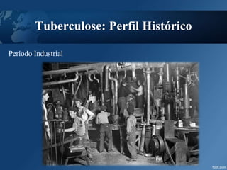 Tuberculose: Perfil Histórico
Período Industrial
 