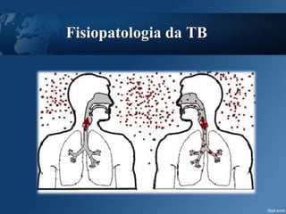 Fisiopatologia da TB
 