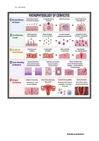 Comprehensive Overview of Acute and Chronic Cervicitis: Pathophysiology ...