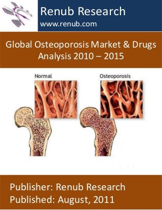 Global Osteoporosis Market & Drugs
Analysis 2010 – 2015
Renub Research
www.renub.com
Publisher: Renub Research
Published: August, 2011
 