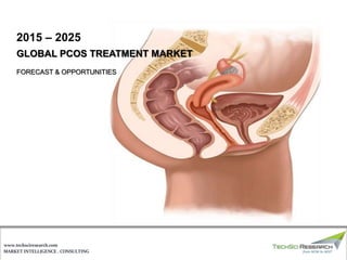 MARKET INTELLIGENCE . CONSULTING
www.techsciresearch.com
GLOBAL PCOS TREATMENT MARKET
FORECAST & OPPORTUNITIES
2015 – 2025
 