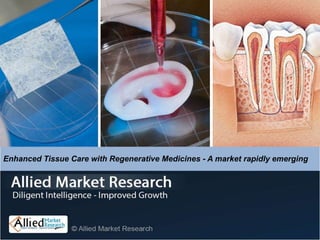 Enhanced Tissue Care with Regenerative Medicines - A market rapidly emerging
 