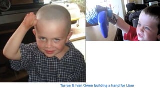 Torrae & Ivan Owen building a hand for Liam
 