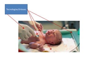Tecnologias/órteses
 